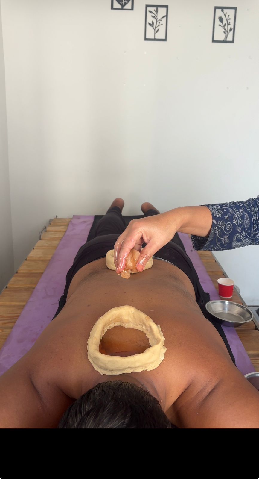 Ayurvedic Wellness Treatment